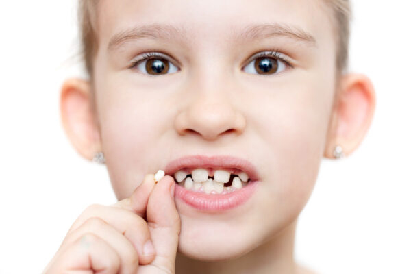 Süt Dişi Çürükleri Nasıl Tedavi Edilir?