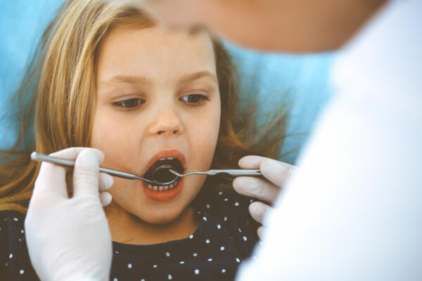 Antalya Çocuklar İçin Fissür Örtücü Nedir?